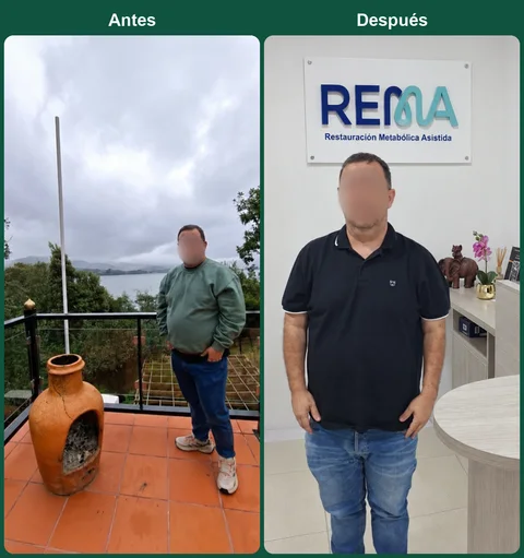 Antes y después de un paciente del programa REMA; rostro protegido