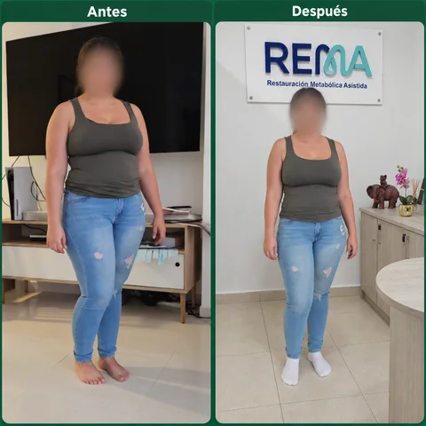 Antes y después de una paciente del programa REMA; rostro protegido